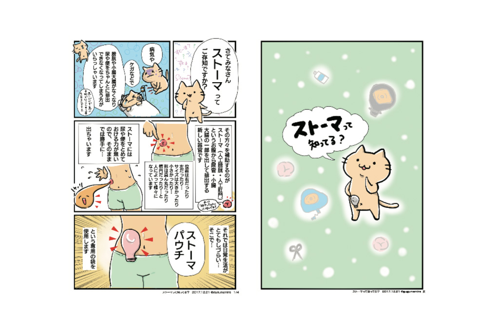 かわいい漫画でわかるストーマ 人工肛門 膀胱 生活 東和商事